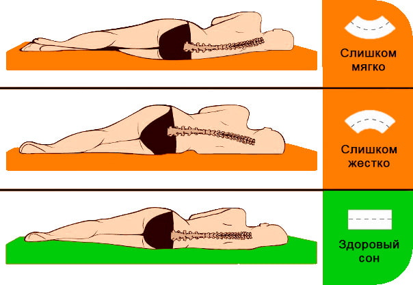 Raideur des matelas orthopédiques